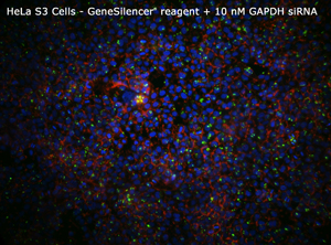 HeLa GeneSilencer+10nM GAPDHsiRNA 