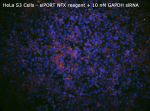 HeLa siPORT NFX+10nM GAPDHsiRNA