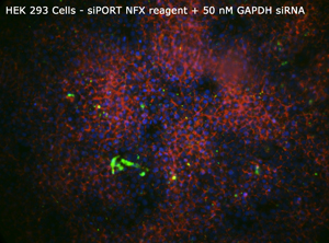 HEK 293 siPORT NFX+50nM GAPDHsiRNA