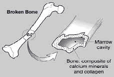 Broken Bone