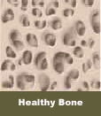 Healthy Bone